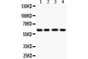 Image no. 1 for anti-Hexosaminidase A (HEXA) (AA 191-207), (Middle Region) antibody (ABIN3044173)