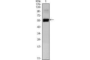 Image no. 2 for anti-Paired Box 6 (PAX6) antibody (ABIN969342)