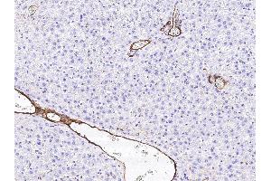 Image no. 1 for anti-Basal Cell Adhesion Molecule (Lutheran Blood Group) (BCAM) (AA 1-543) antibody (ABIN2649549)