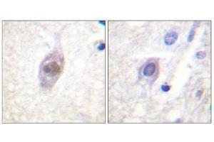 Image no. 1 for anti-Adenomatous Polyposis Coli (APC) (Internal Region) antibody (ABIN1848000)
