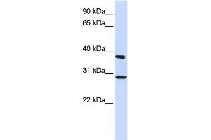 Image no. 1 for anti-Inhibitor of Growth Family, Member 4 (ING4) (Middle Region) antibody (ABIN2784250)