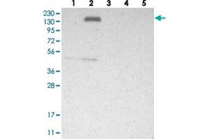 Image no. 1 for anti-Fibronectin Type III Domain Containing 3B (FNDC3B) antibody (ABIN5578271)
