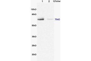 Image no. 3 for anti-TSPY-Like 2 (TSPYL2) (AA 251-350) antibody (ABIN722245)