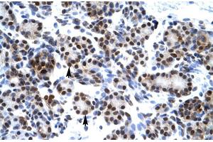 Image no. 1 for anti-Hairy and Enhancer of Split 7 (HES7) (Middle Region) antibody (ABIN2779247)