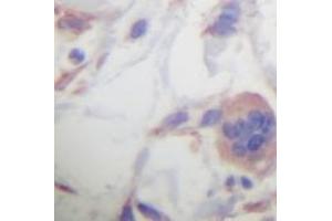 Image no. 2 for anti-Transforming Growth Factor, beta 1 (TGFB1) antibody (ABIN465317)