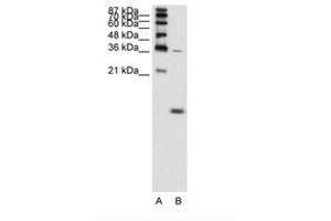 Image no. 2 for anti-Hemoglobin, zeta (HBZ) (AA 31-80) antibody (ABIN204990)