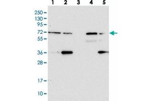 ZNF609 anticorps