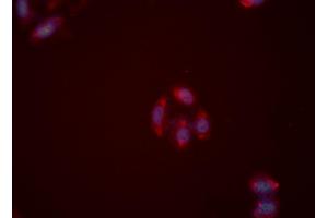 Image no. 2 for anti-Neuropeptide Y Receptor Y2 (NPY2R) antibody (ABIN6257854)