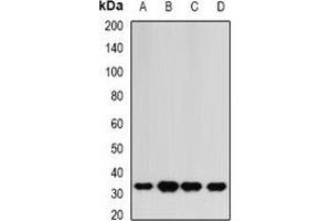 Image no. 3 for anti-Hydroxyacylglutathione Hydrolase (HAGH) antibody (ABIN2966701)