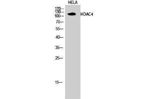 Image no. 1 for anti-Histone Deacetylase 4 (HDAC4) (Tyr493) antibody (ABIN3184987)