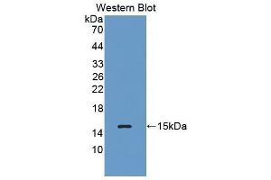 Image no. 1 for anti-Complement Factor B (CFB) (AA 476-592) antibody (ABIN1858374)