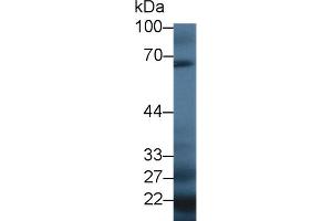Complement Factor I antibody  (AA 358-603)