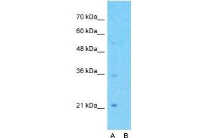 Image no. 1 for anti-G Protein-Coupled Receptor, Family C, Group 5, Member A (GPRC5A) (C-Term) antibody (ABIN2776866)