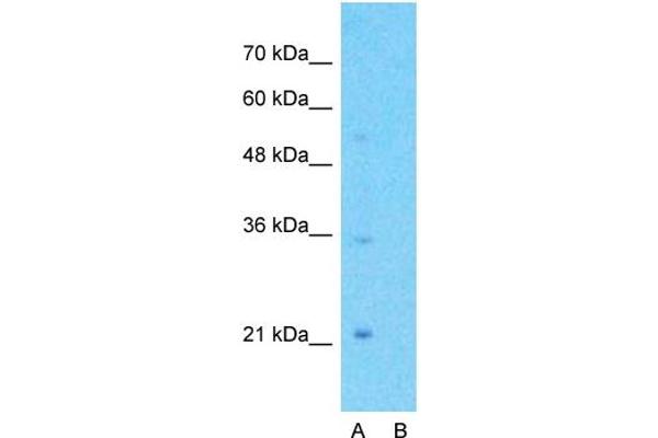 anti-G Protein-Coupled Receptor, Family C, Group 5, Member A (GPRC5A) (C-Term) antibody