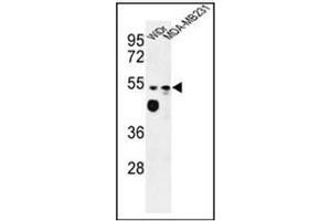Image no. 2 for anti-Tricellulin (MARVELD2) (AA 393-423), (C-Term) antibody (ABIN955328)