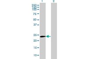 Image no. 1 for anti-Notch 2 N-terminal Like (NOTCH2NL) (AA 1-236) antibody (ABIN531755)