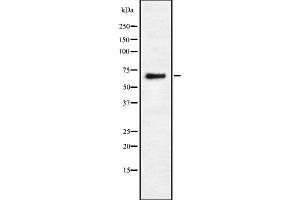 anti-EPS8-Like 3 (EPS8L3) antibody