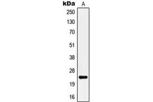 Image no. 1 for anti-Potassium Large Conductance Calcium-Activated Channel, Subfamily M, beta Member 4 (KCNMB4) (Center) antibody (ABIN2706440)