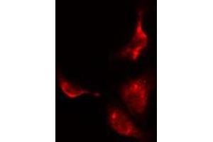 Image no. 2 for anti-Protein Phosphatase 2, Regulatory Subunit B'', gamma (PPP2R3C) (C-Term) antibody (ABIN6259560)