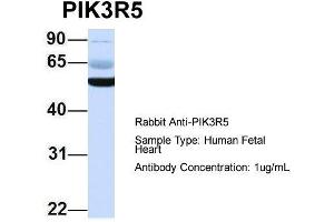 Image no. 4 for anti-Phosphoinositide-3-Kinase, Regulatory Subunit 5 (PIK3R5) (N-Term) antibody (ABIN2786003)