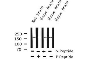 Image no. 3 for anti-Ret Proto-Oncogene (RET) (pTyr1062) antibody (ABIN6256615)