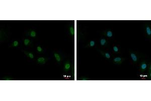 ICC/IF Image UBE2C antibody [N1C3] detects UBE2C protein at cytoplasm and nucleus by immunofluorescent analysis.