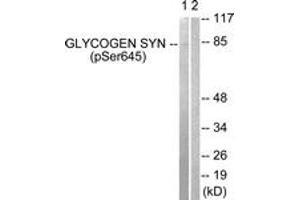 Western blot analysis of extracts from NIH-3T3 cells treated with PMA 125ng/ml 30', using Glycogen Synthase (Phospho-Ser645) Antibody.