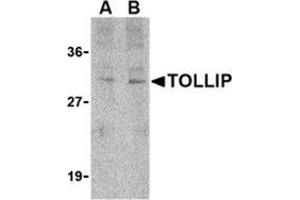 Image no. 2 for anti-Toll Interacting Protein (TOLLIP) (C-Term) antibody (ABIN501006)