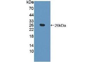 TAGLN2 antibody  (AA 2-199)