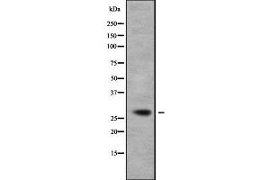 Image no. 2 for anti-RAB23, Member RAS Oncogene Family (RAB23) (C-Term) antibody (ABIN6264565)