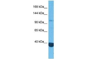 Image no. 2 for anti-Histone Deacetylase 4 (HDAC4) (Middle Region) antibody (ABIN2778342)