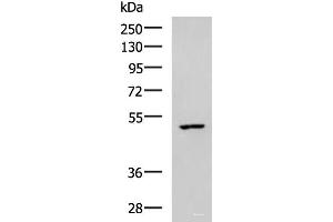 Western blot analysis of MCF7 cell lysate using CKMT1A/CKMT1B Polyclonal Antibody at dilution of 1:600