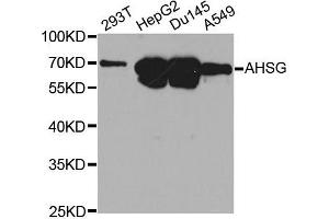 Image no. 2 for anti-alpha-2-HS-Glycoprotein (AHSG) antibody (ABIN3022317)