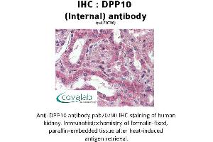 Image no. 2 for anti-Dipeptidylpeptidase 10 (DPP10) (Internal Region) antibody (ABIN1733744)