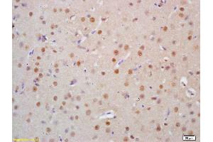 Formalin-fixed and paraffin embedded rat brain tissue labeled Anti-HSTF2/HSF2 Polyclonal Antibody, Unconjugated (ABIN686137) at 1:200, followed by conjugation to the secondary antibody and DAB staining