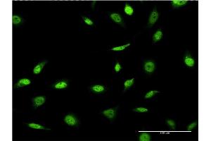 Image no. 4 for anti-Small Nuclear RNA Activating Complex, Polypeptide 4, 190kDa (SNAPC4) (AA 53-162) antibody (ABIN562931)