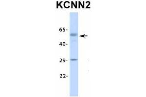 Image no. 3 for anti-Potassium Intermediate/small Conductance Calcium-Activated Channel, Subfamily N, Member 2 (KCNN2) (Middle Region) antibody (ABIN2776295)