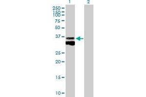 Image no. 1 for anti-Cathepsin B (CTSB) (AA 1-339) antibody (ABIN514769)