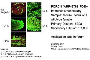 Image no. 2 for anti-Porcupine Homolog (PORCN) (N-Term) antibody (ABIN2783888)