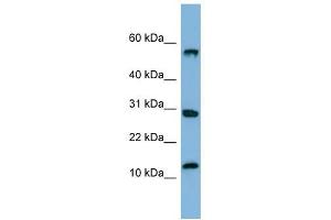 Image no. 1 for anti-Signal Recognition Particle 19kDa (SRP19) (Middle Region) antibody (ABIN633423)