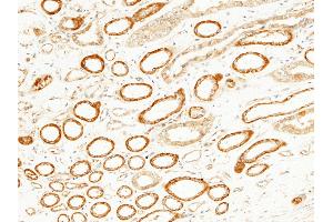Image no. 3 for anti-Mitogen-Activated Protein Kinase 9 (MAPK9) (AA 1-424) antibody (ABIN1997375)