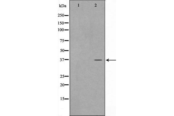 anti-Cyclin-Dependent Kinase-Like 4 (CDKL4) (Internal Region) antibody