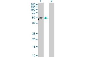 Image no. 1 for anti-Immunoglobulin Heavy Constant gamma 1 (G1m Marker) (IGHG1) (AA 1-469) antibody (ABIN1327632)