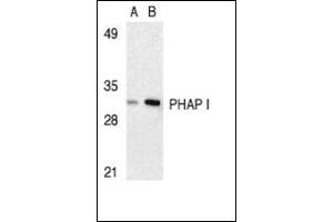 Image no. 2 for anti-Acidic (Leucine-Rich) Nuclear phosphoprotein 32 Family, Member A (ANP32A) (C-Term) antibody (ABIN500483)
