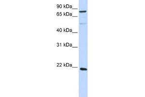 Image no. 1 for anti-ADP-Ribosylation Factor-Like 11 (ARL11) (Middle Region) antibody (ABIN2785008)