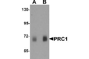 Image no. 1 for anti-Protein Regulator of Cytokinesis 1 (PRC1) (Middle Region) antibody (ABIN1031045)