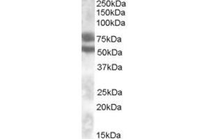 Image no. 1 for anti-Dachshund 1 (DACH1) (Internal Region) antibody (ABIN334382)
