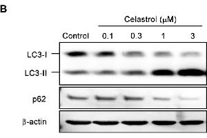 Image no. 22 for anti-Sequestosome 1 (SQSTM1) (Internal Region) antibody (ABIN2854836)