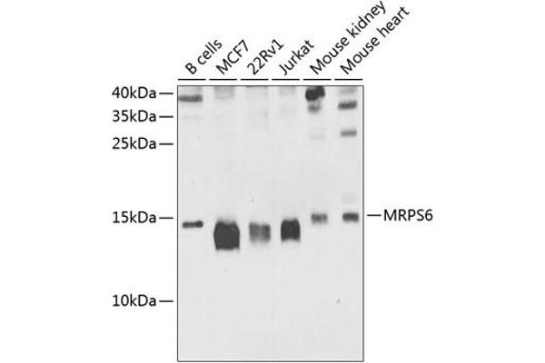 MRPS6 Antikörper  (AA 1-125)