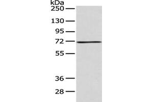 Gel: 8 % SDS-PAGE, Lysate: 40 μg, Lane: 293T cell, Primary antibody: ABIN7128186(ACSM5 Antibody) at dilution 1/200 dilution, Secondary antibody: Goat anti rabbit IgG at 1/8000 dilution, Exposure time: 30 seconds